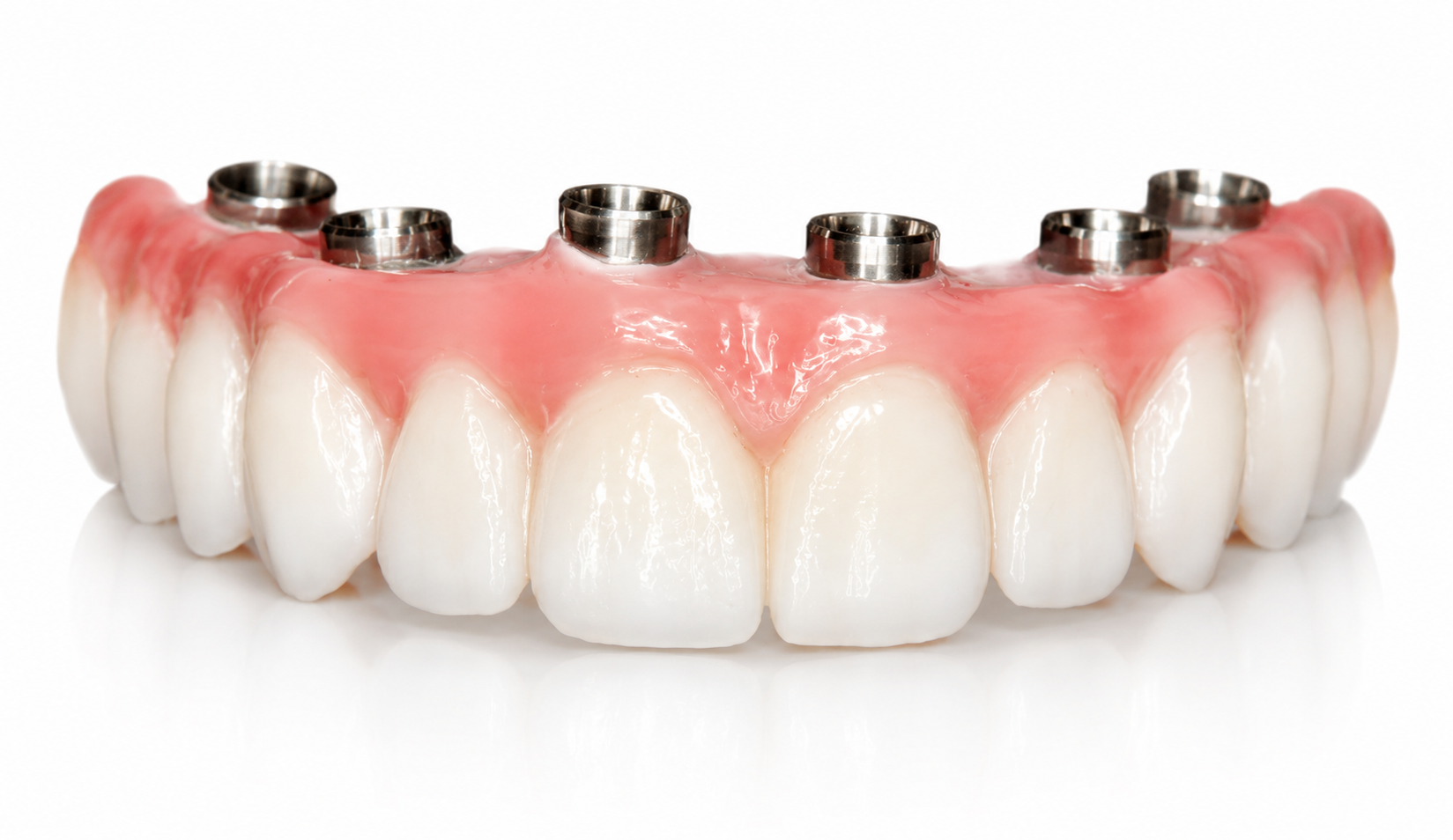 Implante Dentário Adequa